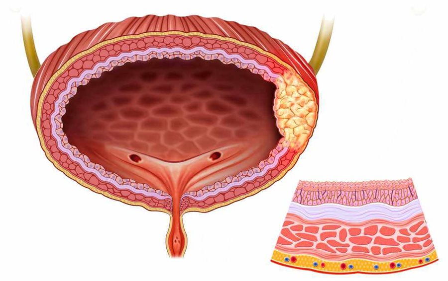 Mesane ve mesane duvarı katmanlarını gösteren anatomik çizim